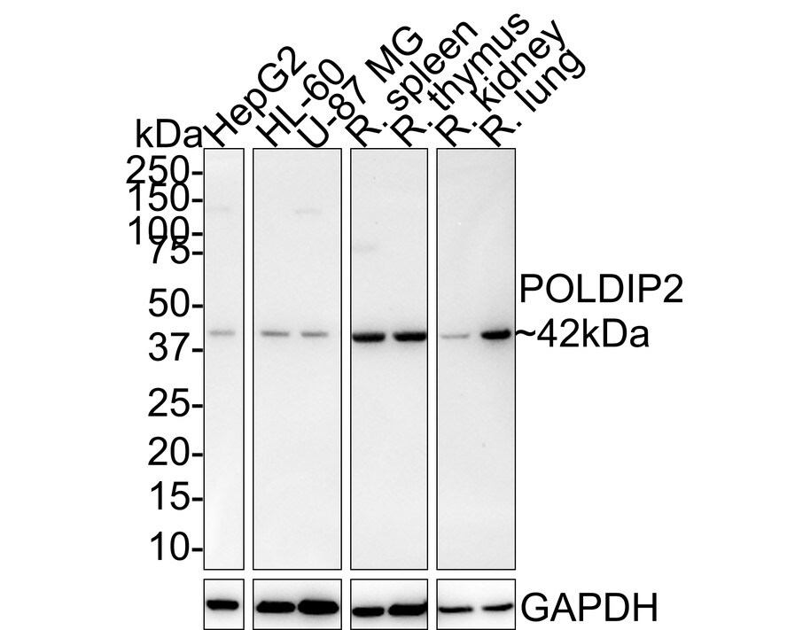 POLDIP2 Antibody (PSH01-20) Western Blot: POLDIP2 Antibody (PSH01-20) [NBP3-32839]