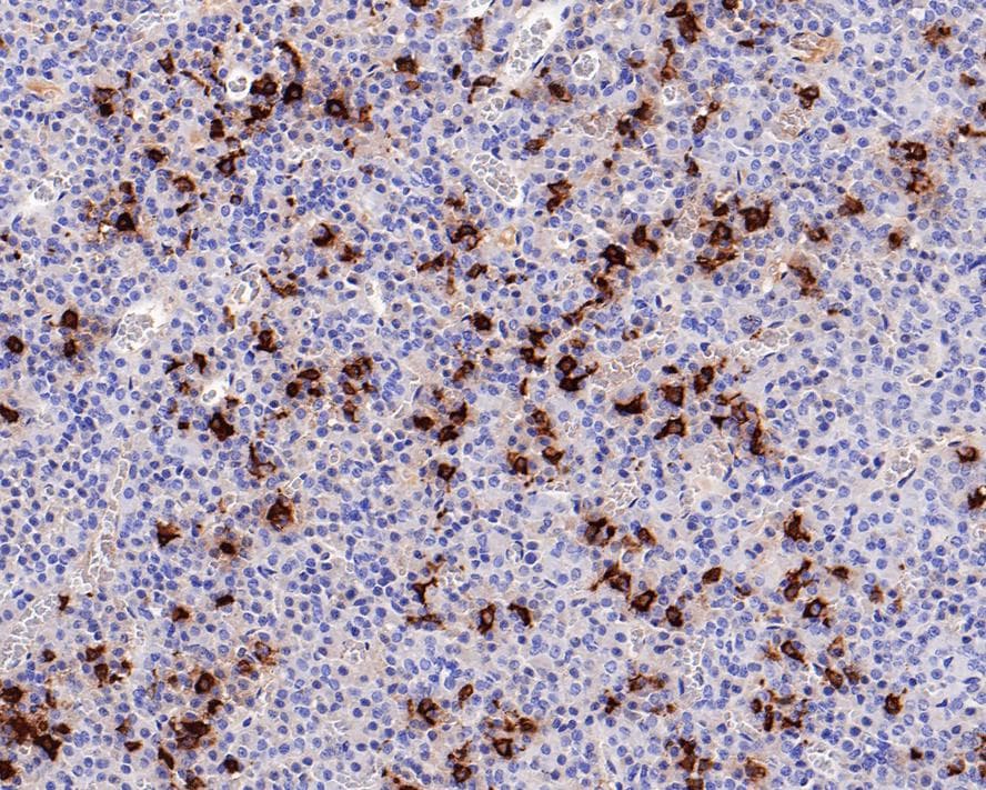 POMC Antibody (PD01-40)
