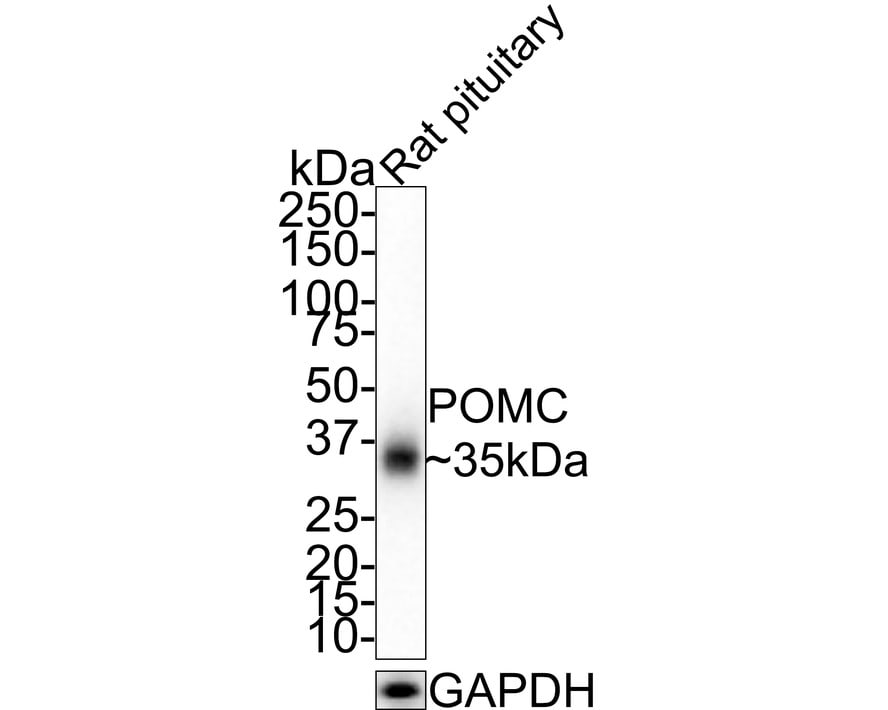 POMC Antibody (JE32-88)