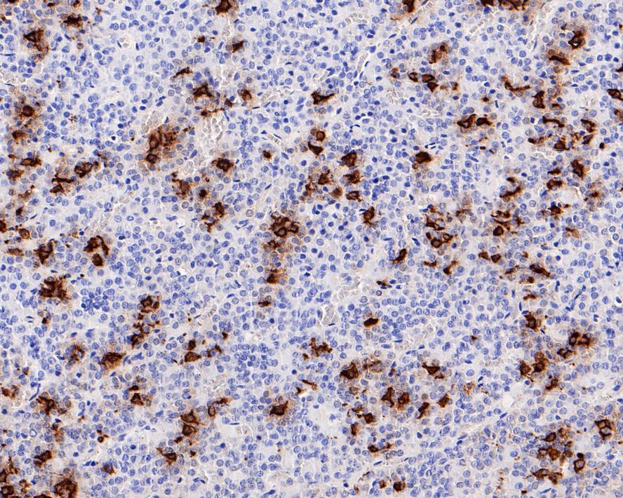 POMC Antibody (JE32-88)