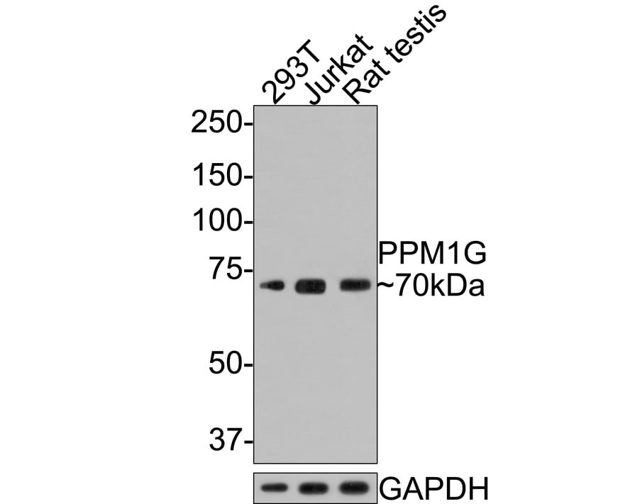 PP2C gamma/PPM1G Antibody (JE64-91) Western Blot: PP2C gamma/PPM1G Antibody (JE64-91) [NBP3-32844]