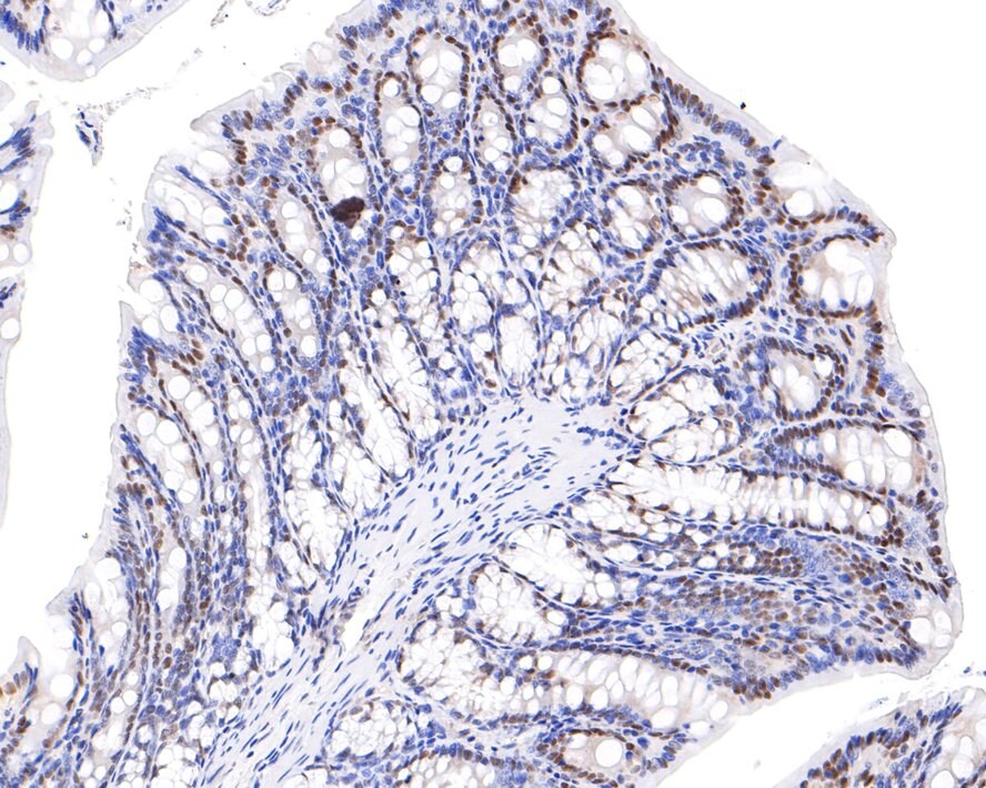 PP2C gamma/PPM1G Antibody (JE64-91)