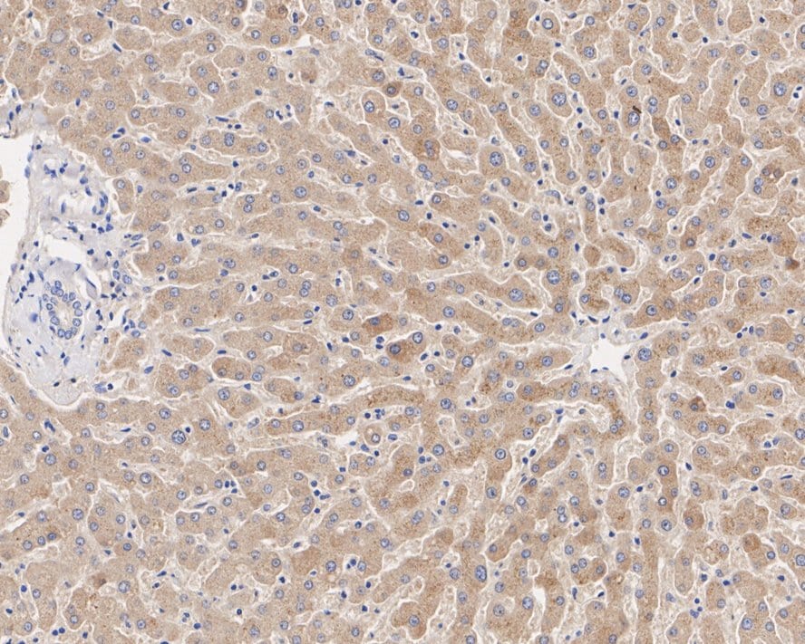 PPP2R1B Antibody (PSH02-92)