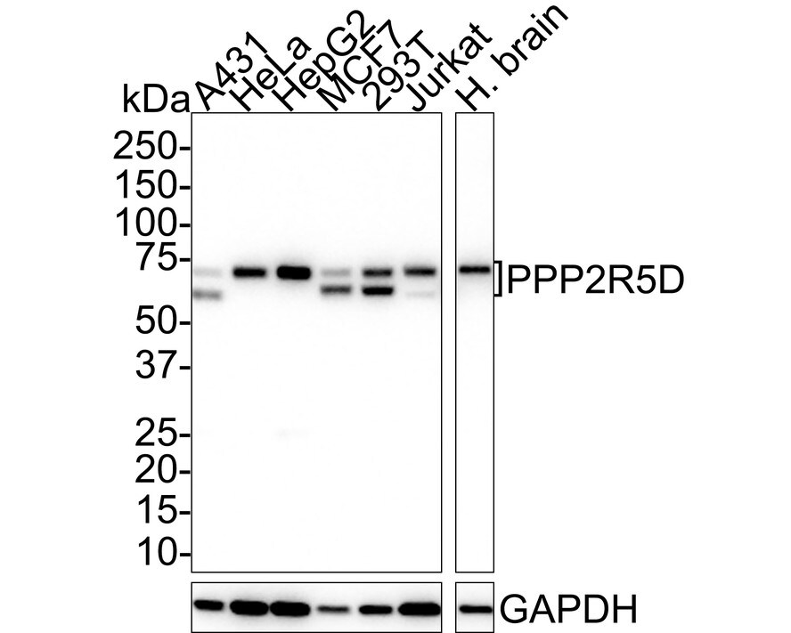 PPP2R5D Antibody (PSH01-21)