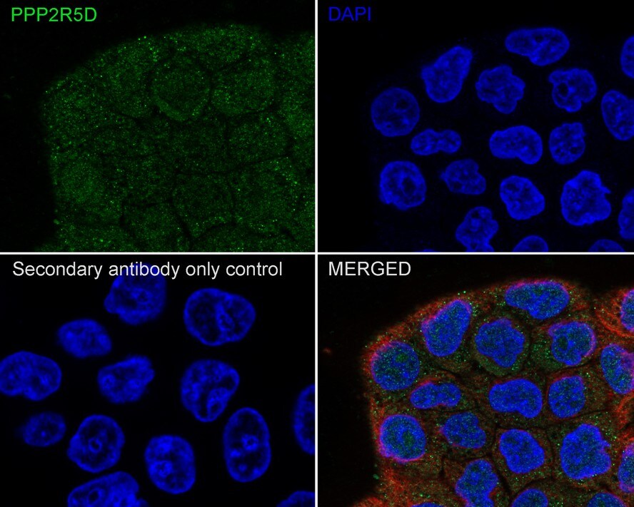 PPP2R5D Antibody (PSH01-21)