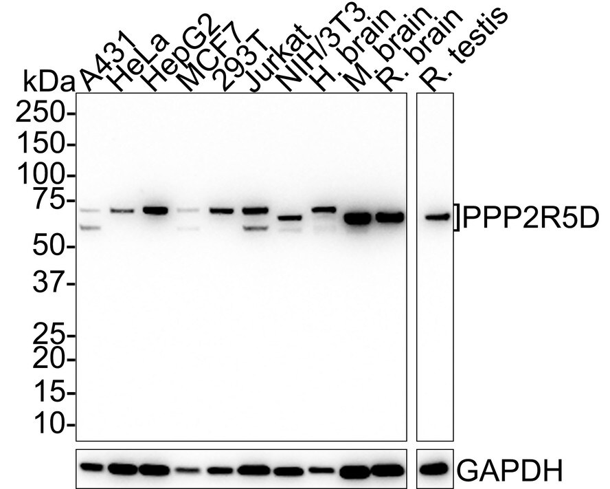 PPP2R5D Antibody (PSH01-22) Western Blot: PPP2R5D Antibody (PSH01-22) [NBP3-32847]