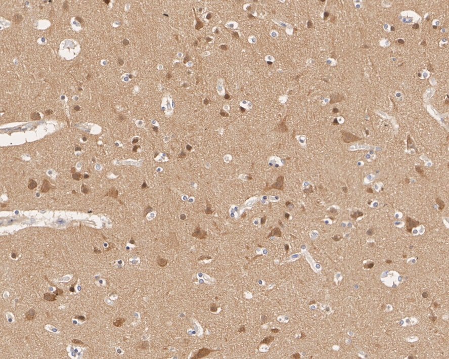 PPP2R5D Antibody (PSH01-22)