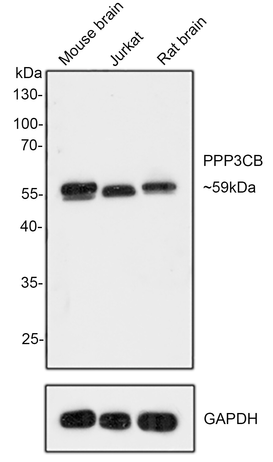 PPP3CB Antibody (PSH0-21)