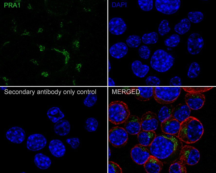 PRA1 Antibody (PSH01-96)