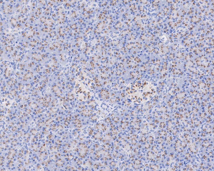 PRA1 Antibody (PSH01-96)