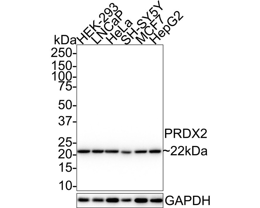 Peroxiredoxin 2 Antibody (7F5-R) Western Blot: Peroxiredoxin 2 Antibody (7F5-R) [NBP3-32851]