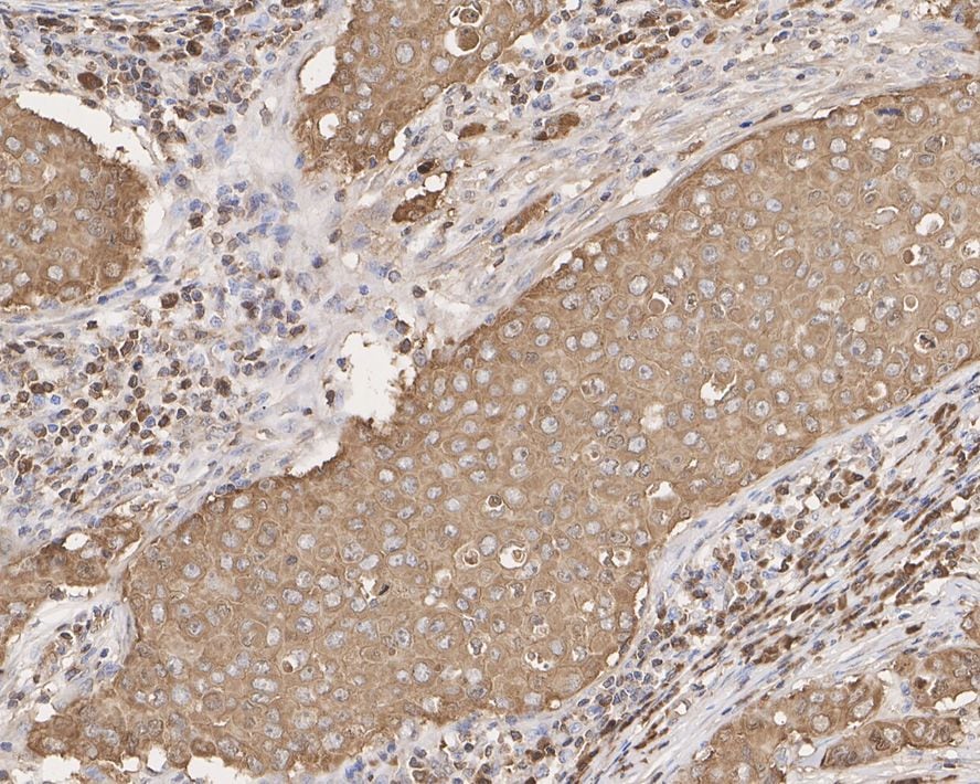 Peroxiredoxin 2 Antibody (7F5-R)
