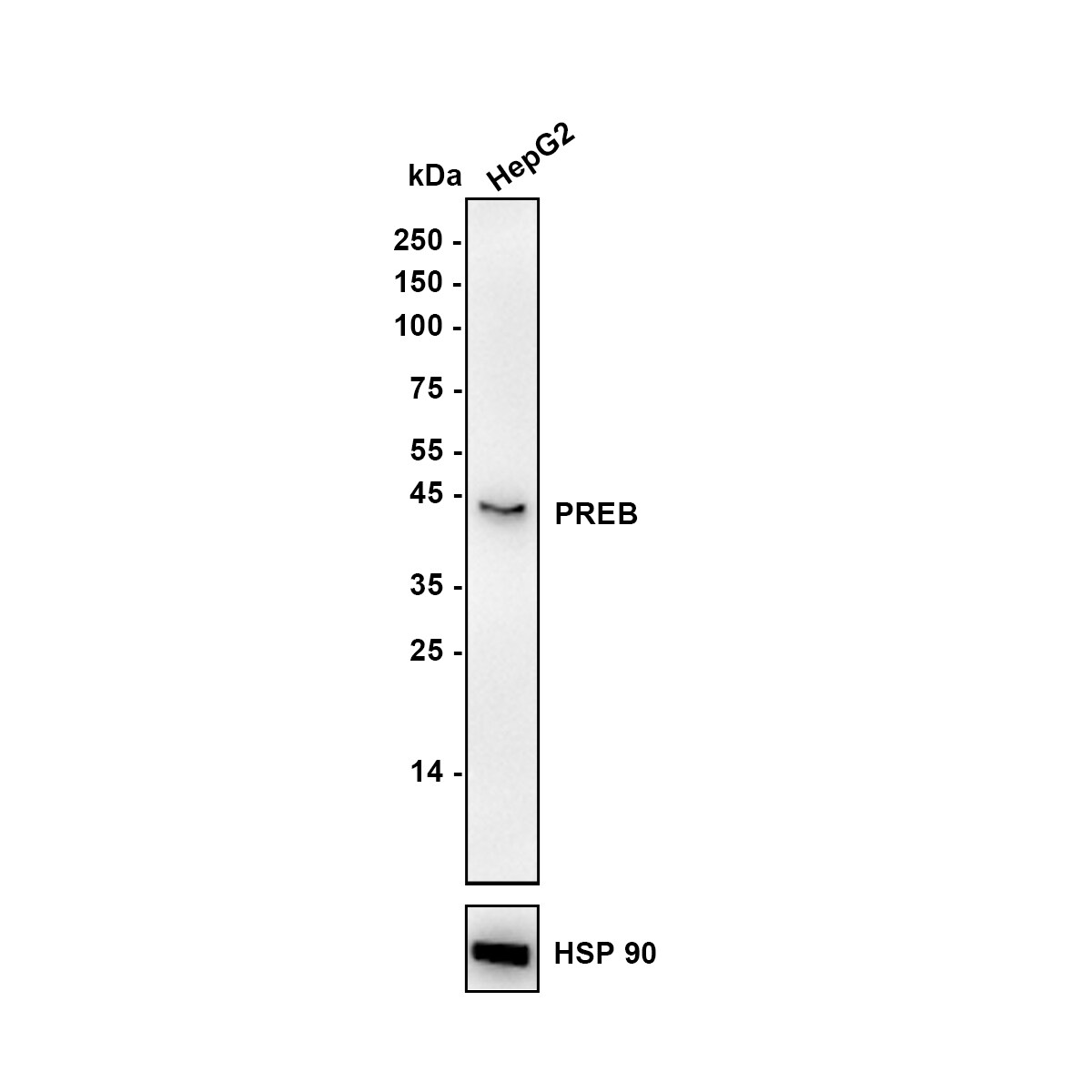 PREB Antibody (JE64-56) Western Blot: PREB Antibody (JE64-56) [NBP3-32852]