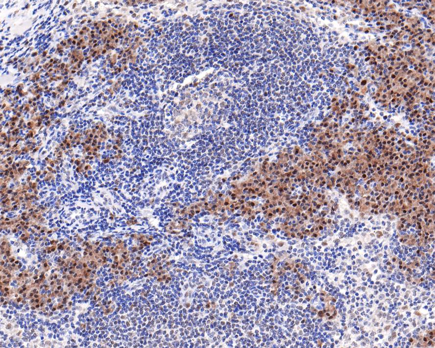 PREB Antibody (JE64-56)