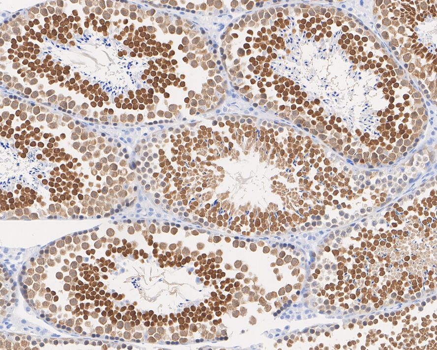 PRMT7 Antibody (JE64-78)