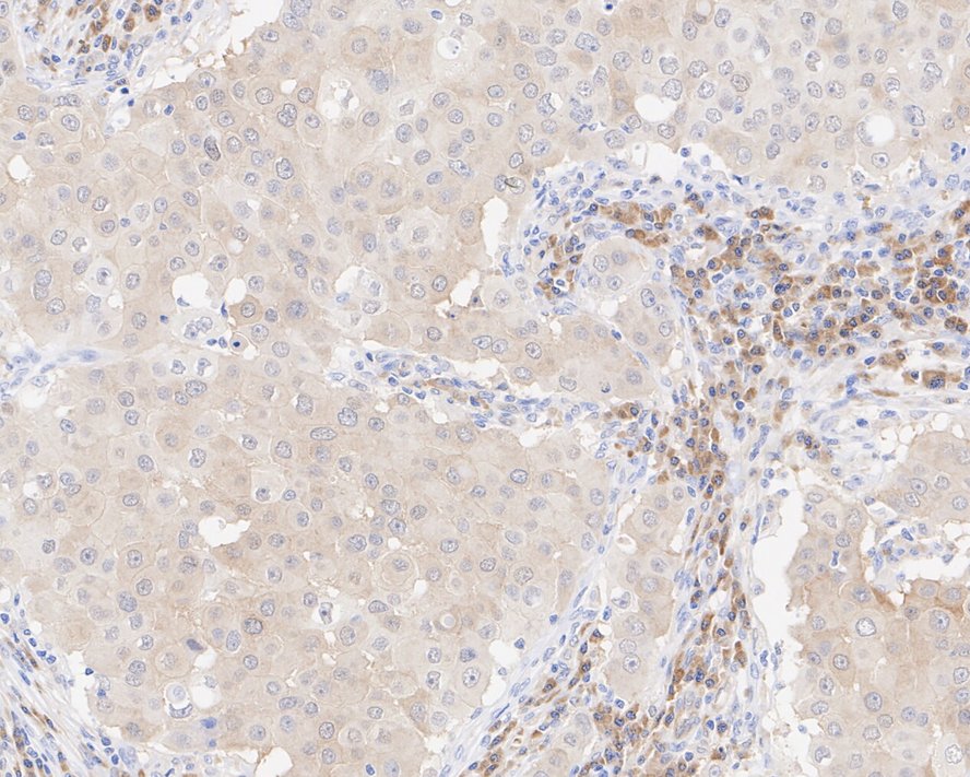 Caspase-10/FLICE2 Antibody (JE59-42) - Pro