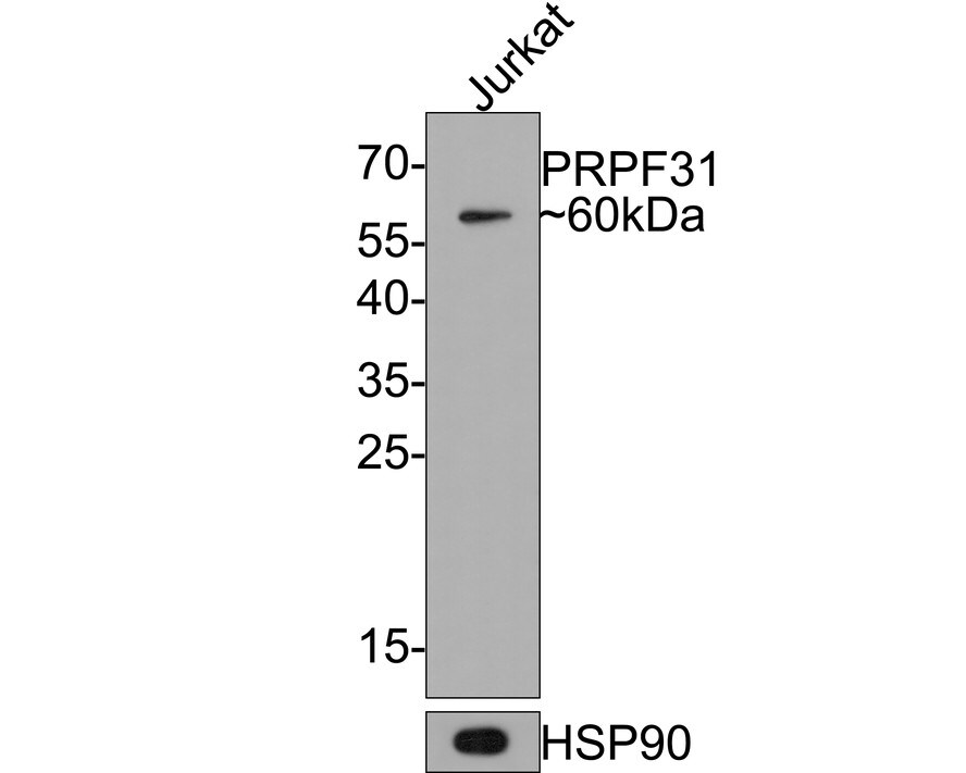 PRPF31 Antibody (JE64-82) Western Blot: PRPF31 Antibody (JE64-82) [NBP3-32857]