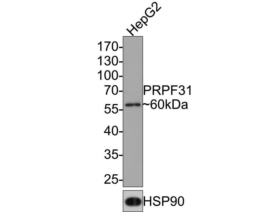 PRPF31 Antibody (JE64-82) Western Blot: PRPF31 Antibody (JE64-82) [NBP3-32857]