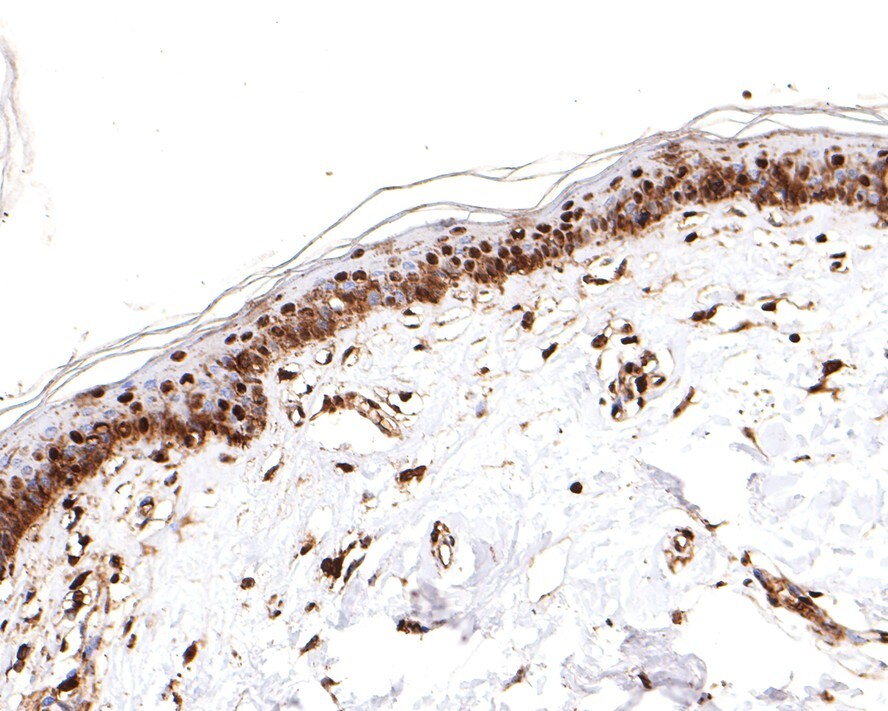 PRPF31 Antibody (JE64-82)