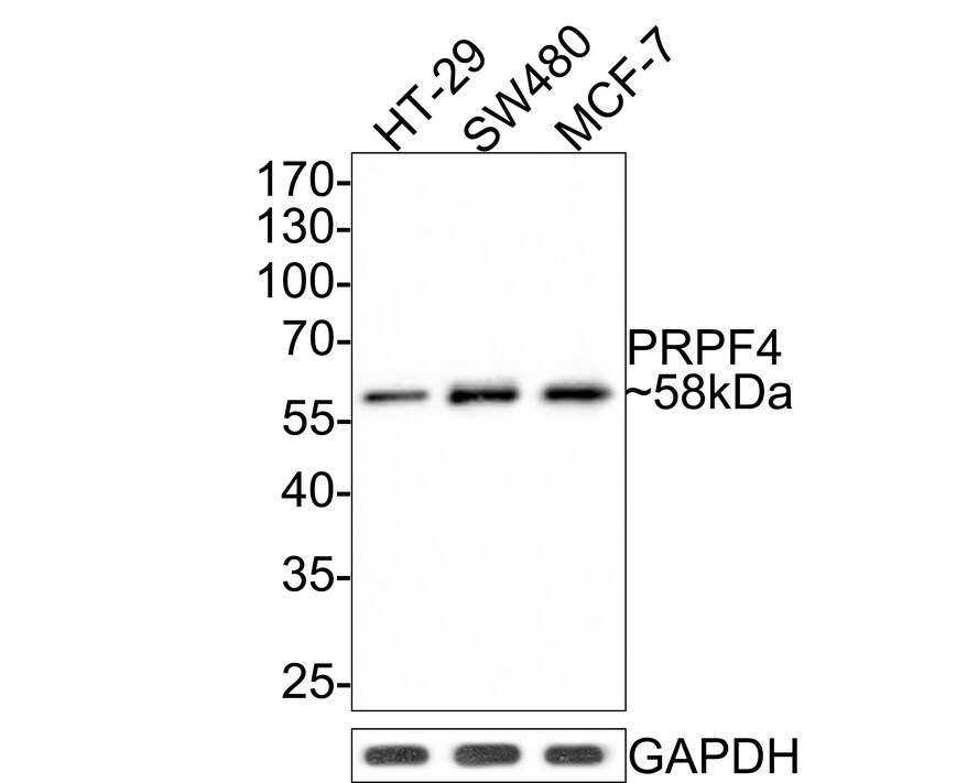 PRPF4 Antibody (JE65-37) Western Blot: PRPF4 Antibody (JE65-37) [NBP3-32858]