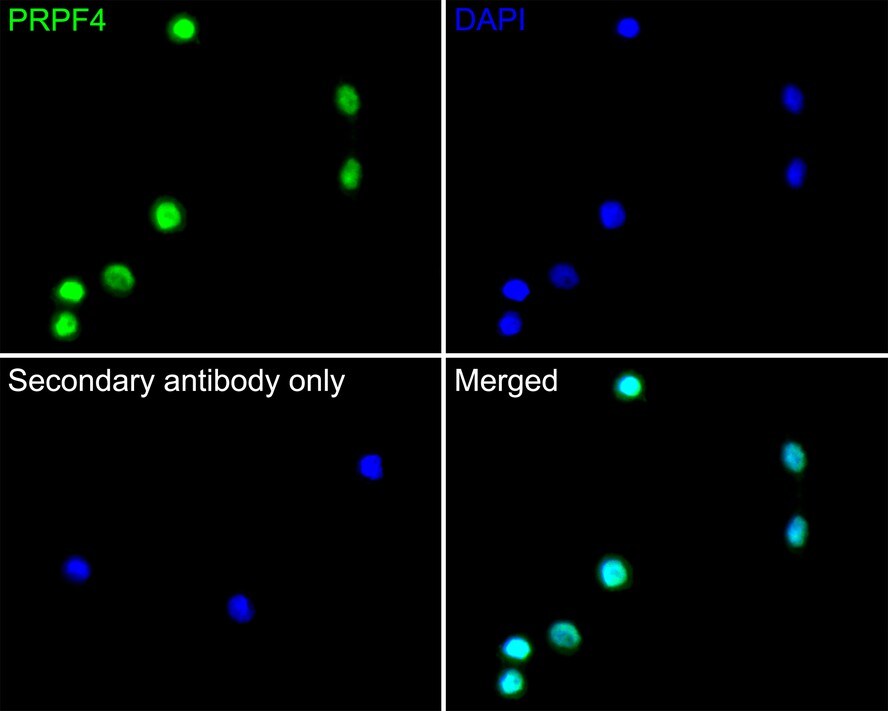 PRPF4 Antibody (JE65-37)