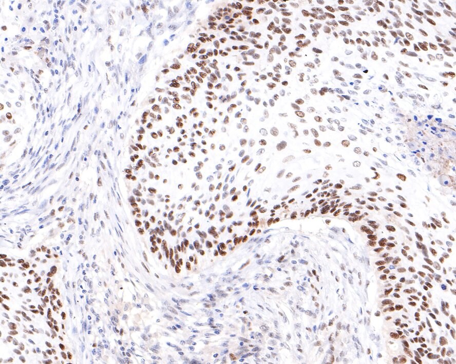 PRPF4 Antibody (JE65-37)