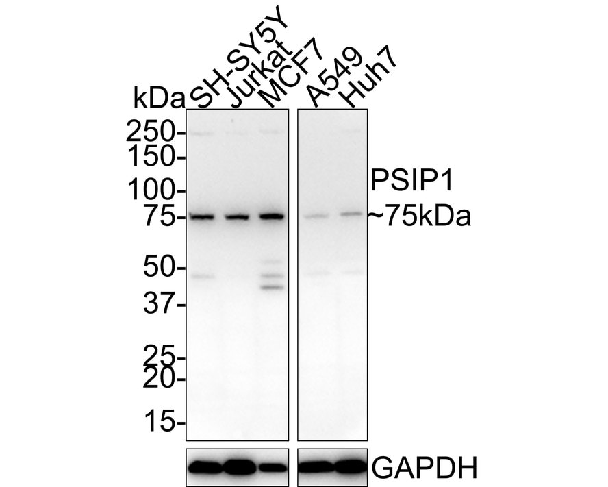 LEDGF Antibody (JE75-02)