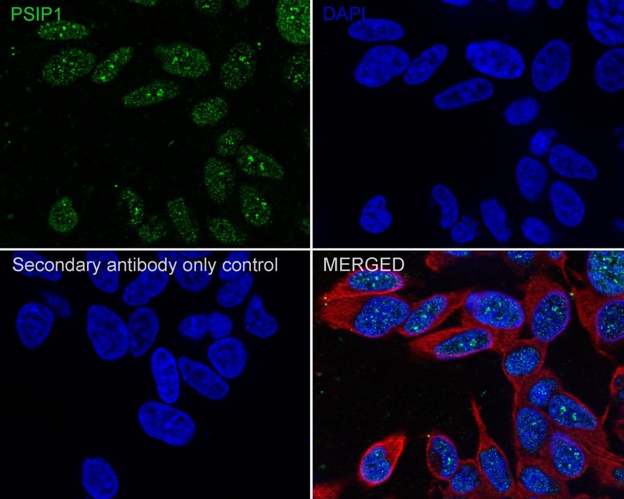 LEDGF Antibody (PSH02-55)