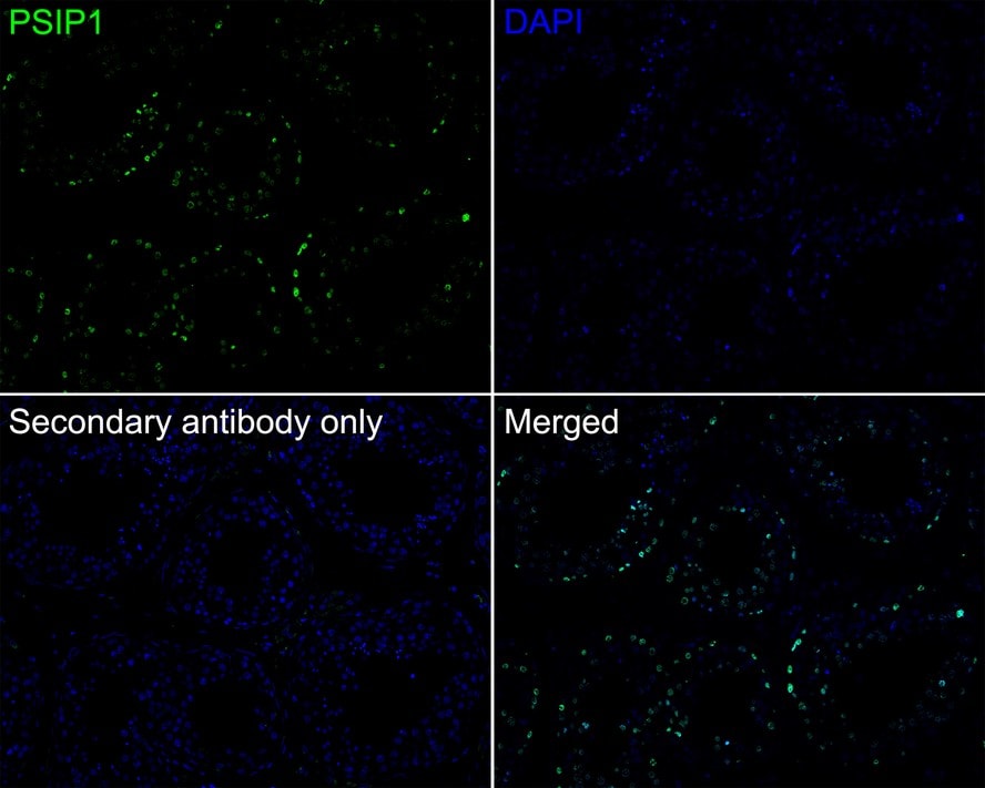 LEDGF Antibody (PSH02-55)