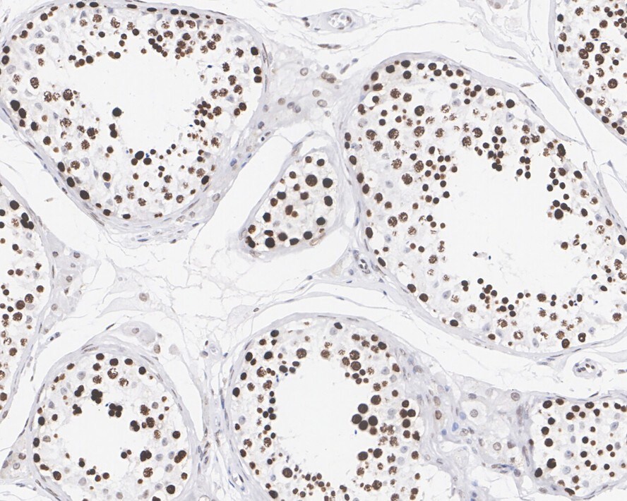 LEDGF Antibody (PSH02-55)