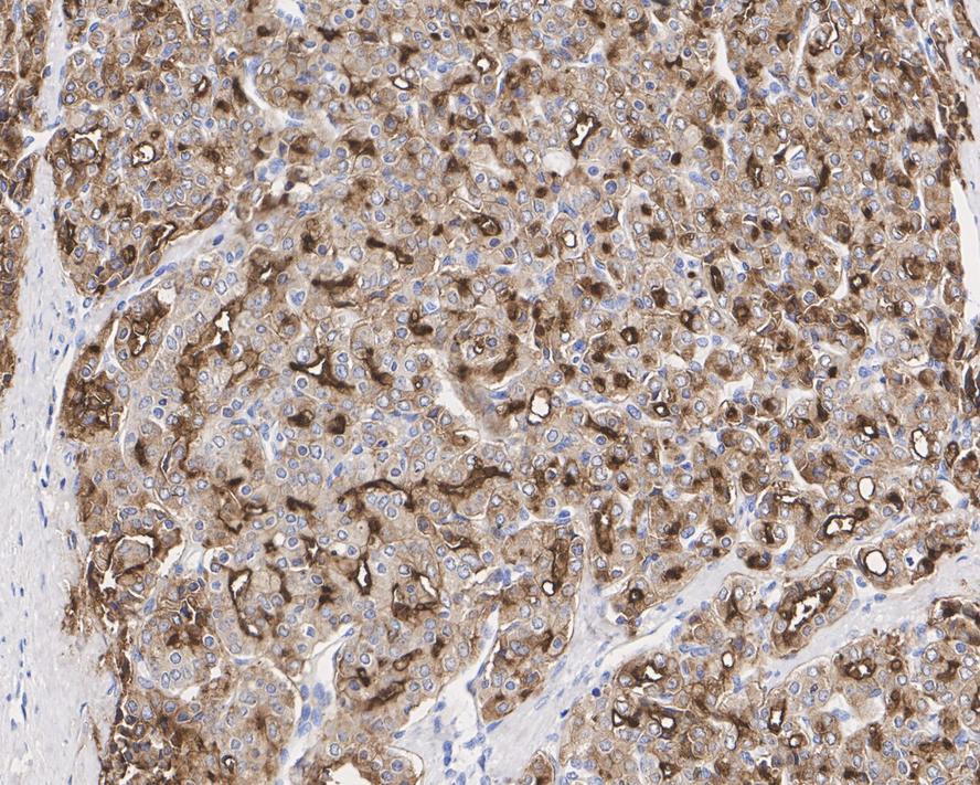 PSMA/FOLH1/NAALADase I Antibody (JE42-45)