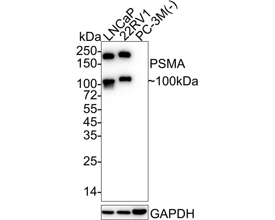 PSMA/FOLH1/NAALADase I Antibody (PD00-72) Western Blot: PSMA/FOLH1/NAALADase I Antibody (PD00-72) [NBP3-32862]