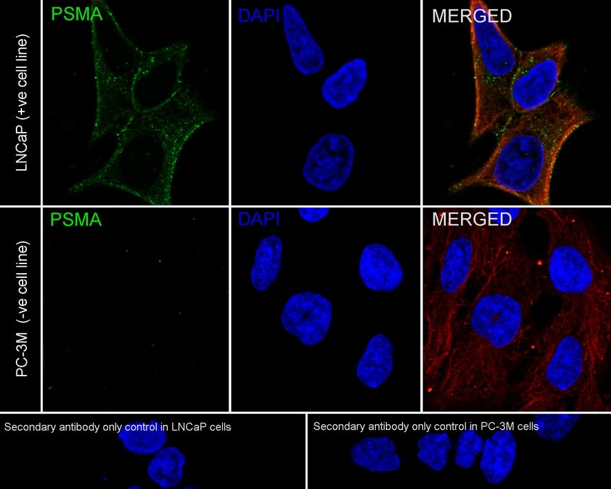 PSMA/FOLH1/NAALADase I Antibody (PD00-72)