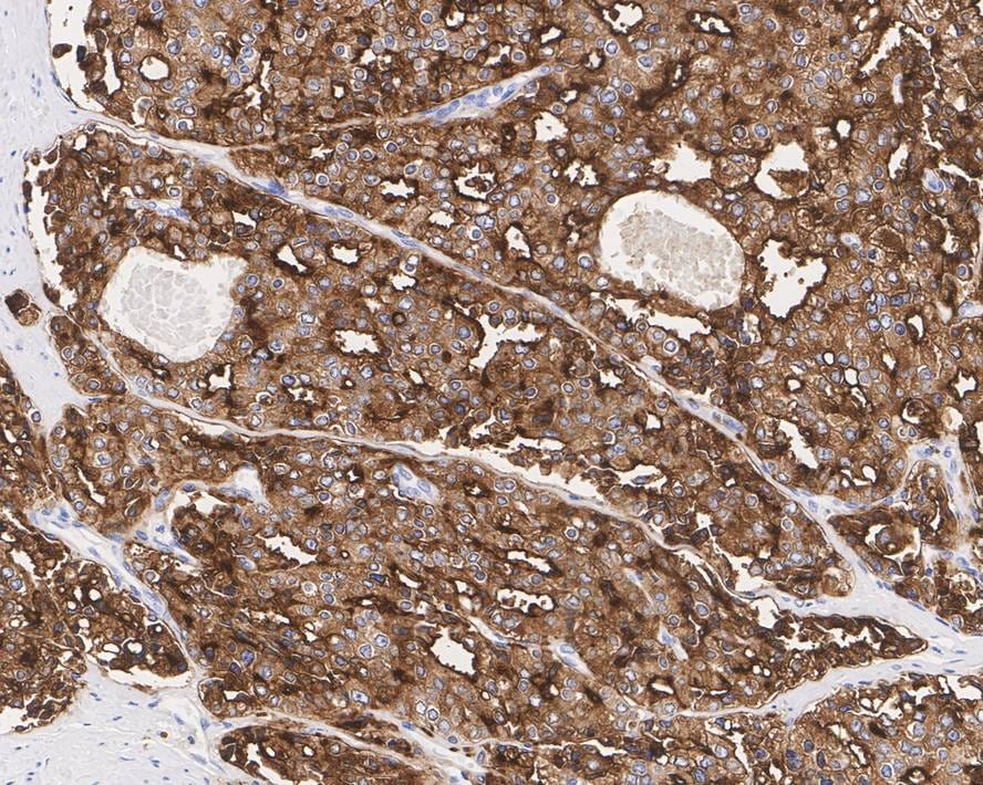 PSMA/FOLH1/NAALADase I Antibody (PD00-72)