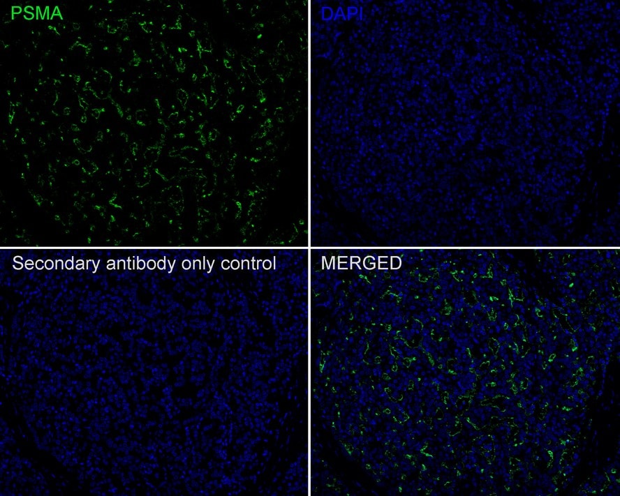 PSMA/FOLH1/NAALADase I Antibody (PD00-72)