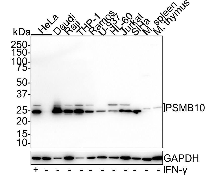 PSMB10/MECL1 Antibody (PSH01-58) Western Blot: PSMB10/MECL1 Antibody (PSH01-58) [NBP3-32863]