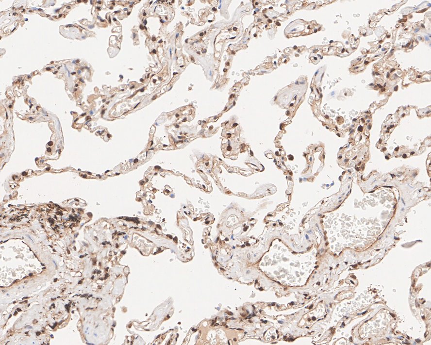 PSMB10/MECL1 Antibody (PSH01-58)