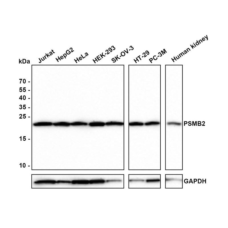 Proteasome 20S beta2 Antibody (PSH0-28) Western Blot: Proteasome 20S beta2 Antibody (PSH0-28) [NBP3-32864]