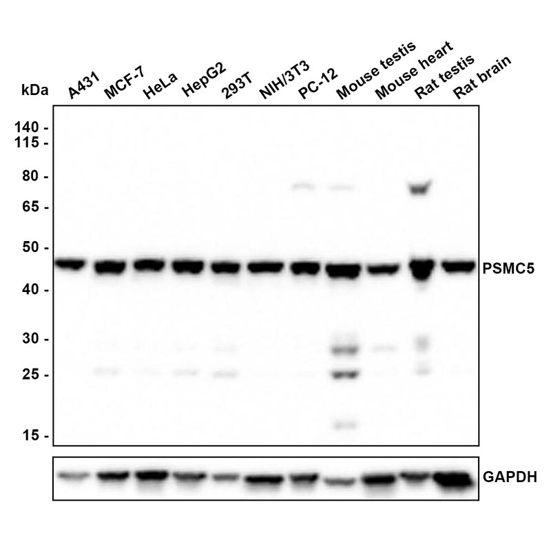 SUG1 Antibody (PSH0-22) Western Blot: SUG1 Antibody (PSH0-22) [NBP3-32865]