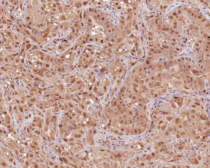 SUG1 Antibody (PSH0-22)