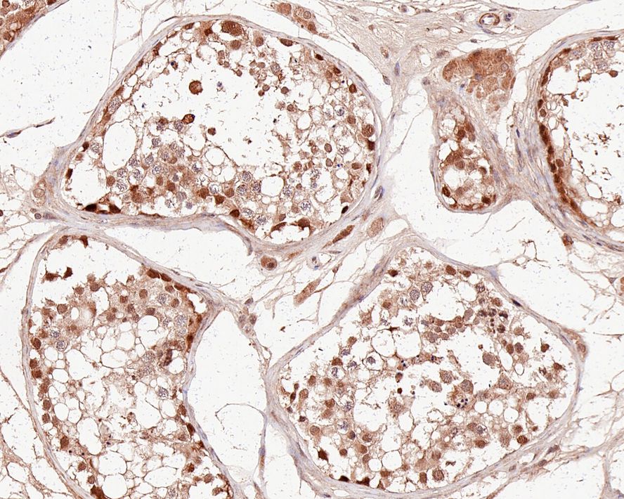 PSMC6 Antibody (PSH0-12)