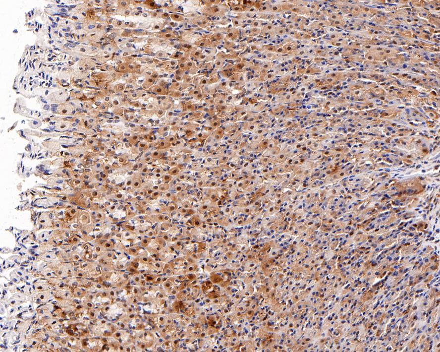 PA28 Activator beta Subunit/PSME2 Antibody (PSH0-10)