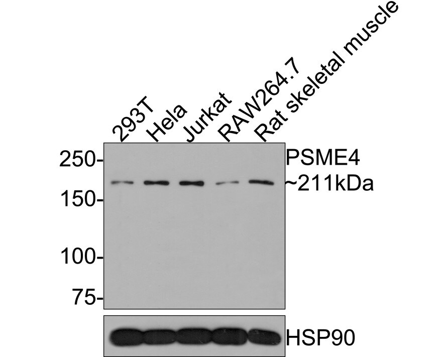 PSME4 Antibody Western Blot: PSME4 Antibody [NBP3-32869]