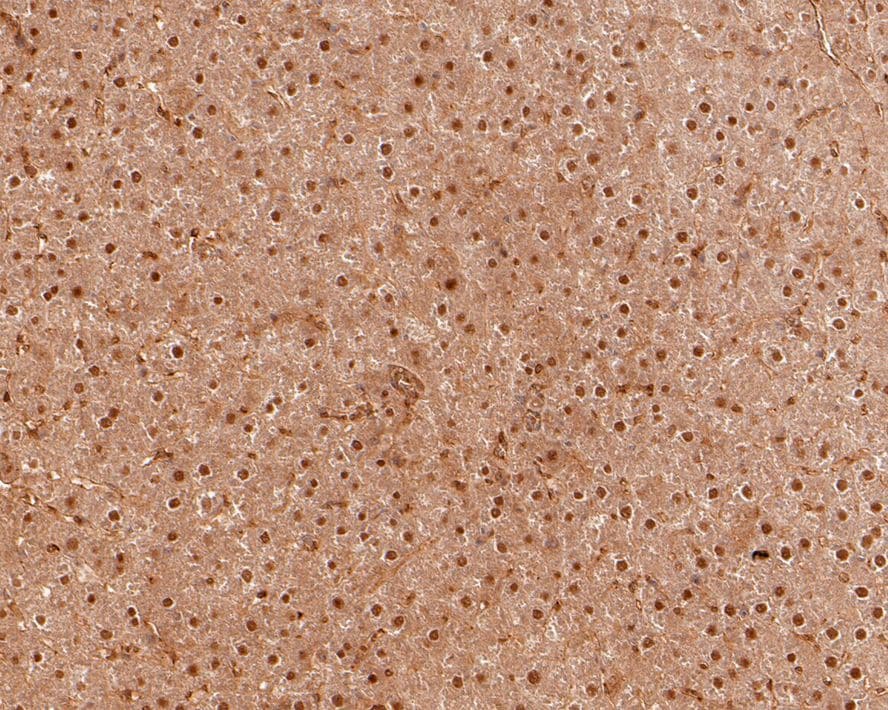 PSME4 Antibody