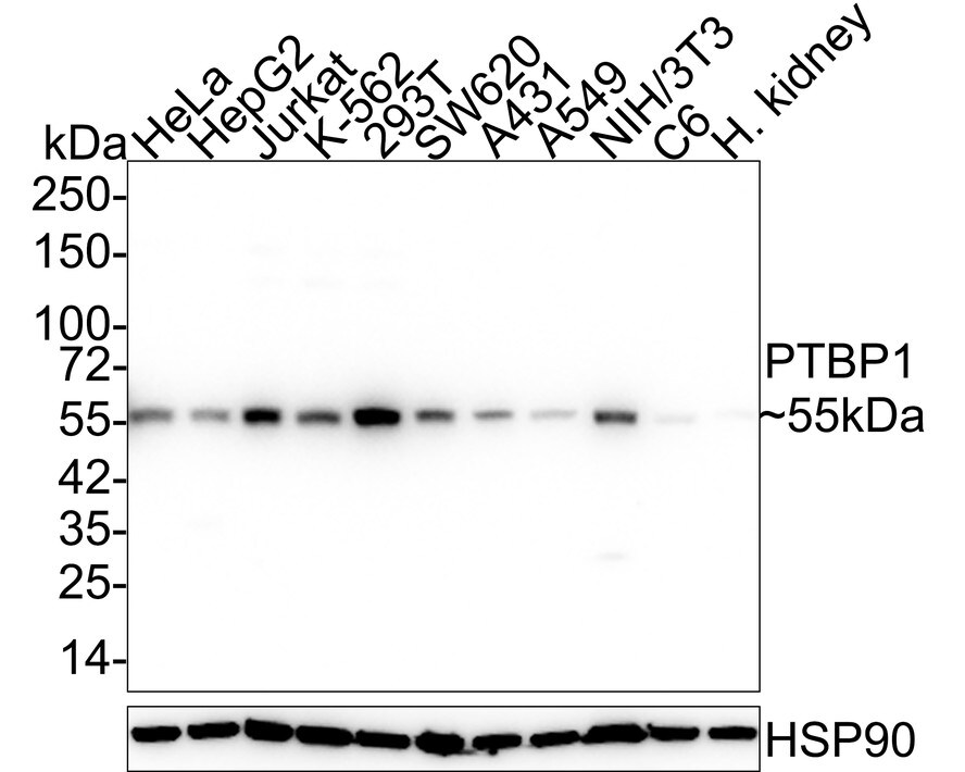 PTBP1 Antibody (5C1-R) Western Blot: PTBP1 Antibody (5C1-R) [NBP3-32870]
