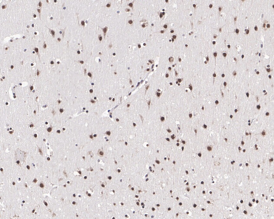 PTBP2 Antibody (JE66-55)
