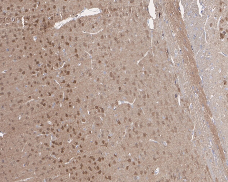 PTEN Antibody (JE51-96)