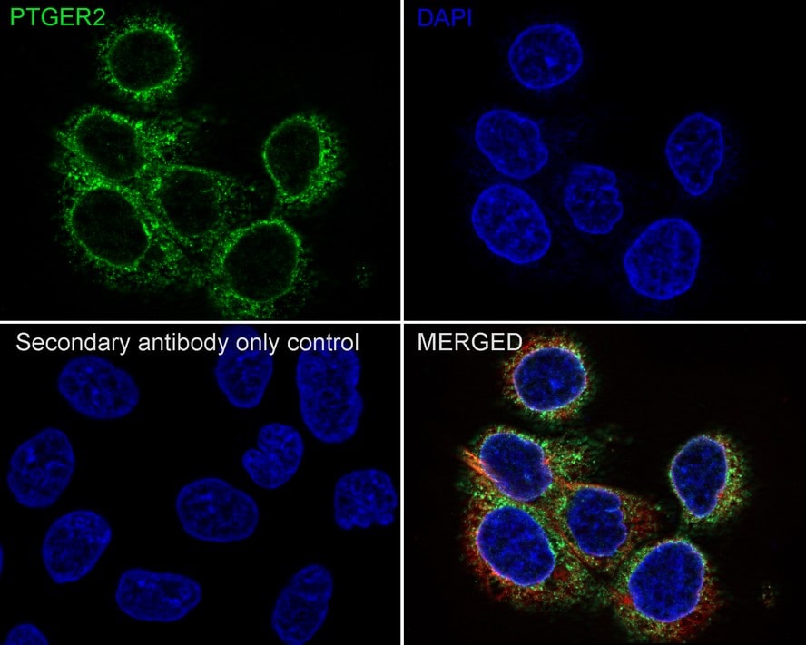 PTGER2 Antibody (JE30-72)