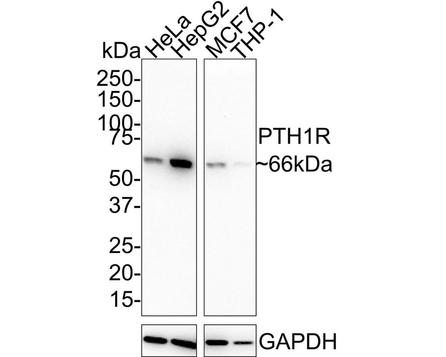 PTH1R/PTHR1 Antibody (JE36-10)