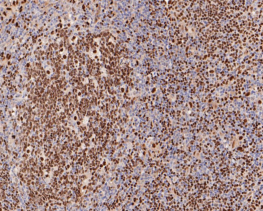 PU.1/Spi-1 Antibody (PD00-14)
